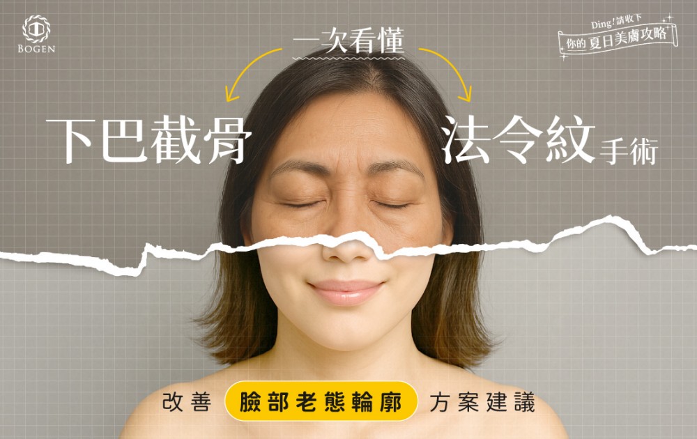 下巴截骨+法令紋手術,法令紋貴族手術,博恩妍